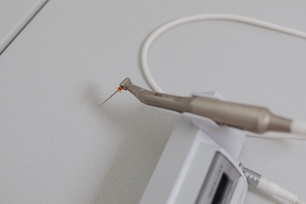 Cuándo es necesario hacer una endodoncia
