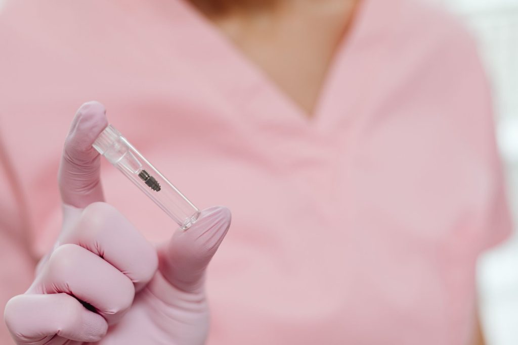 como se colocan los implantes dentales
