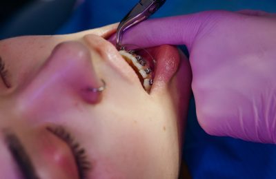 la mejor clinica dental en getafe